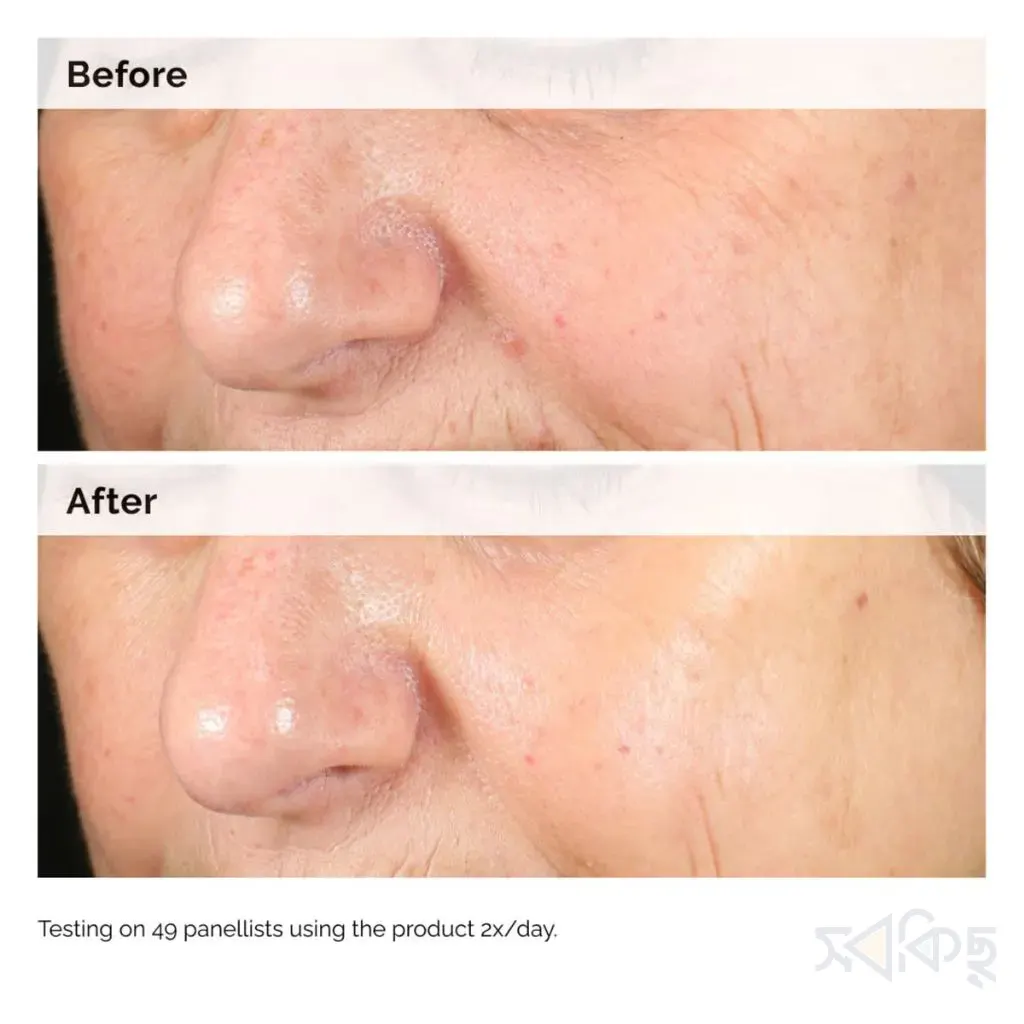 The Ordinary Alpha Arbutin 2% + HA Concentrated Serum 30ml - 5